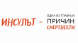 Инсульт